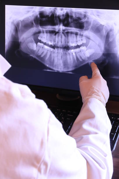 Best Chipped Tooth Repair Near Me  in Hampton, TN