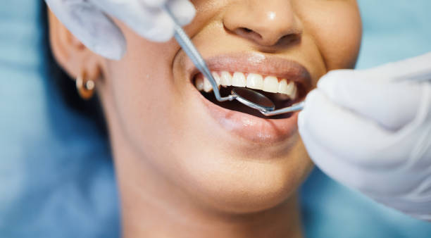 Best Dentist for Tooth Abscess  in Hampton, TN