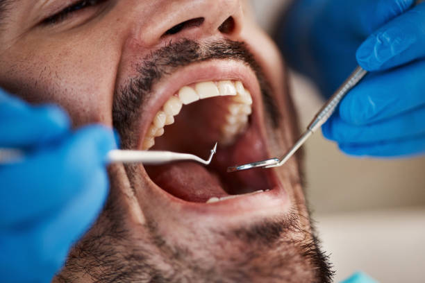 Best Tooth Infection Emergency Dentist  in Hampton, TN